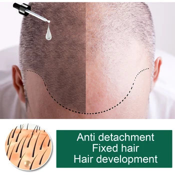 5 Dana Đumbir Rast Kose Eterična Ulja Za Oporavak Oštećene Kose Ulje Tekuće Serum Za žene za Njegu kose Za muškarce Sredstva Protiv opadanja kose